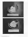 Fig. 02 - Pellets Comprising a Core With a Water-Soluble Carrier