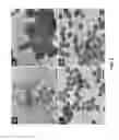 Fig. 09 - Methods of flash reduction and patterning of graphite oxide and its polymer composites