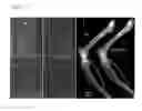 Fig. 20 - DIAGNOSTIC METHODS FOR DETECTING CONGENITAL BONE DEFECTS