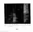 Fig. 02 - DIAGNOSTIC TEST FOR PARKINSON'S DISEASE