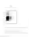 Fig. 02 - Abnormal prion protein binder, and method for detection of abnormal prion protein