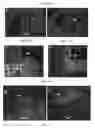 Fig. 12 - AMPK modulation as a method of regulating stem cell and cancer stem cell proliferation, self-renewal and differentiation