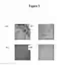 Fig. 04 - SUBSTRATES, DEVICES, AND METHODS FOR QUANTITATIVE LIQUID CRYSTAL ASSAYS