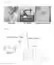 Fig. 02 - PROCESS FOR DIFFERENTIATION OF VASCULAR ENDOTHELIAL PROGENITOR CELLS FROM EMBRYOID BODIES DERIVED FROM EMBRYONIC STEM CELLS USING HYPOXIC MEDIA CONDITION
