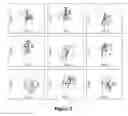 Fig. 04 - COMPOSITIONS AND METHODS FOR TREATING AND DIAGNOSING IRRITABLE BOWEL SYNDROME