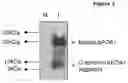 Fig. 04 - Protease-sensitive site in apolipoprotein A1, therapeutic and diagnostic implications