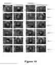 Fig. 14 - Peptides with the capacity to bind to transforming growth factor β1 (TGF-β1)