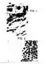 Fig. 02 - METHOD FOR TRANSDIFFERENTIATION OF BODY TISSUES