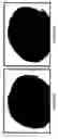 Fig. 06 - Pharmaceutical composition for treating hair loss