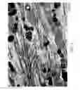 Fig. 02 - Selective ablation of pain-sensing neurons by administration of a vanilloid receptor agonist