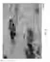 Fig. 03 - Selective ablation of pain-sensing neurons by administration of a vanilloid receptor agonist