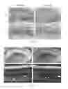 Fig. 08 - Method to Diagnose, Predict Treatment Response and Develop Treatment for Psychiatric Disorders Using Markers