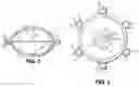 Fig. 02 - Expandable brachytherapy device