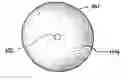 Fig. 01 - Subcutaneous biopsy cavity marker device
