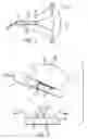 Fig. 02 - Method and apparatus for assessing risk of preterm delivery