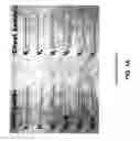 Fig. 02 - Differentiating ischemic from non-ischemic T-wave inversion