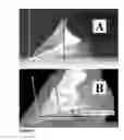 Fig. 03 - METHOD OF MEASURING QUALITY OF THE EQUINE DISTAL PHALLANGE FROM A LATERAL-MEDIAL RADIOGRAPH