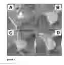 Fig. 04 - METHOD OF MEASURING QUALITY OF THE EQUINE DISTAL PHALLANGE FROM A LATERAL-MEDIAL RADIOGRAPH