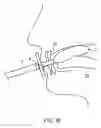 Fig. 12 - Probe for measuring oral pressure, device for measuring oral pressure using the same, and training tool for restoring oral function