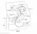 Fig. 07 - INTRA-VAGINAL SENSOR TO MEASURE PELVIC FLOOR LOADING
