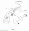 Fig. 02 - Vibration method for clearing acute arterial thrombotic occlusions in the emergency treatment of heart attack and stroke