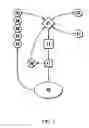 Fig. 08 - Vibration method for clearing acute arterial thrombotic occlusions in the emergency treatment of heart attack and stroke
