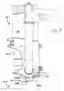 Fig. 09 - Method and apparatus to remove cast from an individual