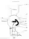 Fig. 02 - EXOPROSTHESIS OR ORTHESIS FOR STABILIZING THE HUMAN KNEE JOINT