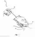 Fig. 02 - CERVICAL TRACTION TREATMENT