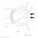 Fig. 07 - Glaucoma treatment method