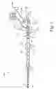 Fig. 06 - Devices and systems for selective auto-retroperfusion of the cerebral venous system