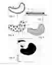 Fig. 02 - Patch With Hydrophilic Adhesive