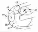 Fig. 01 - MEMS electrochemical bellows actuator