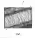 Fig. 05 - Method for controlled electrospinning