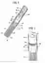 Fig. 02 - Method for anchoring a medical device