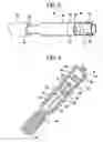 Fig. 03 - Method for anchoring a medical device