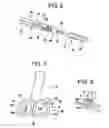 Fig. 04 - Method for anchoring a medical device