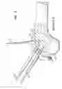 Fig. 06 - Spot facing trochlear groove
