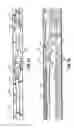 Fig. 41 - Endoscopic surgical clip applier