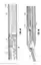 Fig. 43 - Endoscopic surgical clip applier