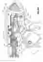 Fig. 44 - Endoscopic surgical clip applier