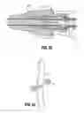 Fig. 49 - Endoscopic surgical clip applier
