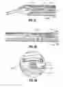 Fig. 52 - Endoscopic surgical clip applier