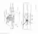 Fig. 74 - Interventional medical closure device