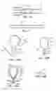Fig. 12 - SYSTEMS AND METHODS OF DE-ENDOTHELIALIZATION