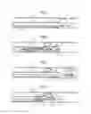 Fig. 04 - EMBOLUS EXTRACTOR