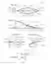 Fig. 06 - EMBOLUS EXTRACTOR