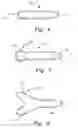 Fig. 06 - Portable Hands-Free Device to Locate and Release Active Trigger Points That Develop in Muscles