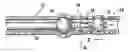 Fig. 01 - Tissue approximation device