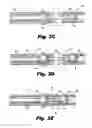 Fig. 04 - Tissue approximation device
